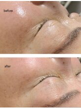 アンベリィ ネイル(embellie nail)/マーメイドセルトリートメント