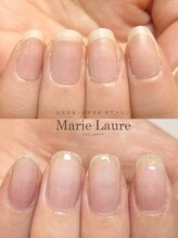 マリーロール 淀屋橋本店(Marie Laure)/自爪育成/深爪矯正/ネイルケア