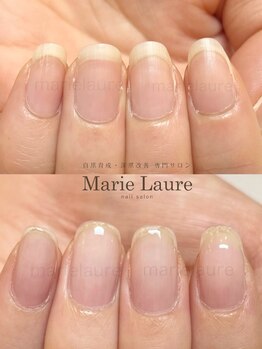 マリーロール 淀屋橋本店(Marie Laure)/自爪育成/深爪矯正/ネイルケア