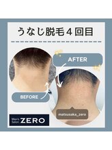 ゼロ 松阪店(ZERO)/頸脱毛
