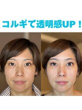 コルギと小顔矯正サロン ウンジョルノ フェリーチェ(un giorno felice)/美肌顔筋&小顔コルギ5回