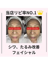 シン(Shin)/【シワ、たるみ改善】