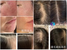 ラヴィス(RAVIS)/新技術！プロセルセラピーズ