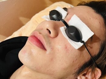 アカヒゲ(AKAHIGE)の写真/【都度払い可能！お乗り換えにも◎】顔脱毛で至近距離でも恥ずかしくない、自信が持てる艶々美肌に!