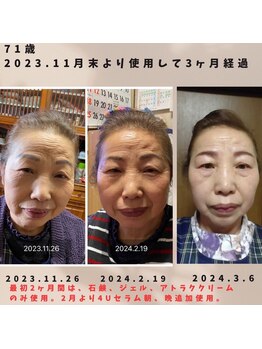 ナナラ(nanala)/当店取り扱いのスキンケア★