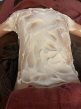 ミルティー(Myrtille)/【背中ニキビケアコース】