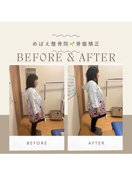 めばえ整骨院/お客様のbefore after