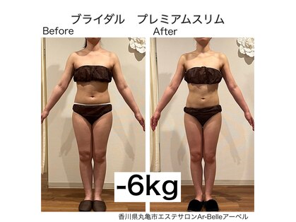 アーベル(Ar-Belle)の写真