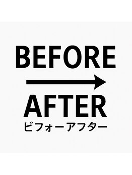 ハンズ治療院 東中野院/「姿勢矯正の症例」