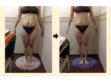 エステティックサロン ピュール ボーテ 東金店/ＢＳＰダイエット