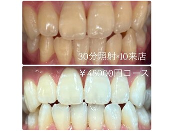 ホワイトニングルーム 横浜店(Whitening Room)/セルフホワイトニング/横浜