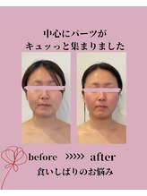 風薫(フウカ)/小顔│ビフォーアフター