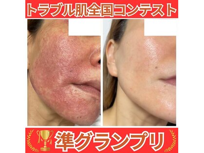 パリライム(parislime)の写真