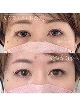 月 自由が丘(tsuki)/《マツエク》左右差あり