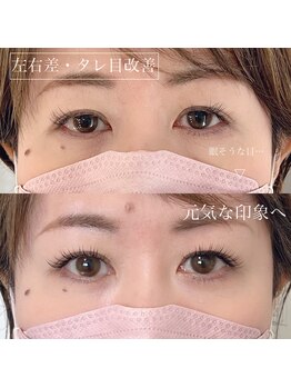 月 自由が丘(tsuki)/《マツエク》左右差あり