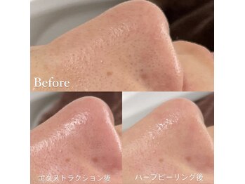 エマ(emma)/見た目が全然違います