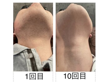 サクロス(Sacloth)/20代後半 首周りスッキリ