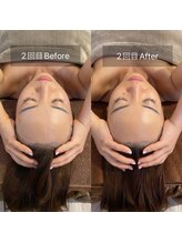 スリージー/before／after