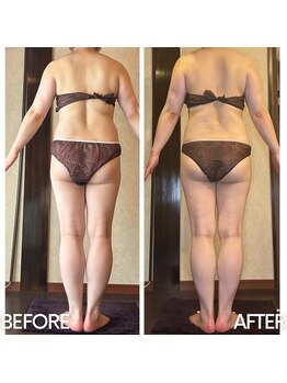 アーユルヴェーダアンドアロマエステ アユス(AYUS)/40代痩身