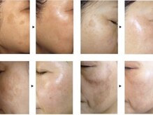 サロンドボーテ ノンノン(Salon de Beaute Non-non)