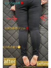 ヨサパーク ココワ(YOSA PARK Cocowa)/１回の全身リンパでこなんなに！