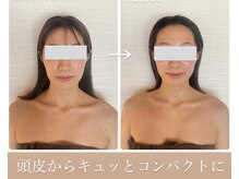 サンサーラ(SAMSARA)の雰囲気（"頭皮"からお顔たるみを引き上げる筋膜小顔矯正は30分間徹底的に）