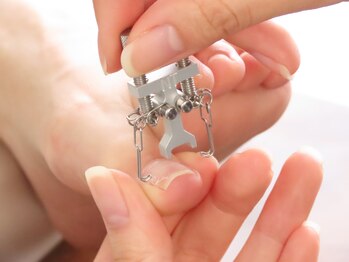 【巻き爪ケア】