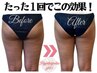 【何度でも◎】下半身徹底ダイエット★ハイパーナイフ&強力リンパ60分￥16000