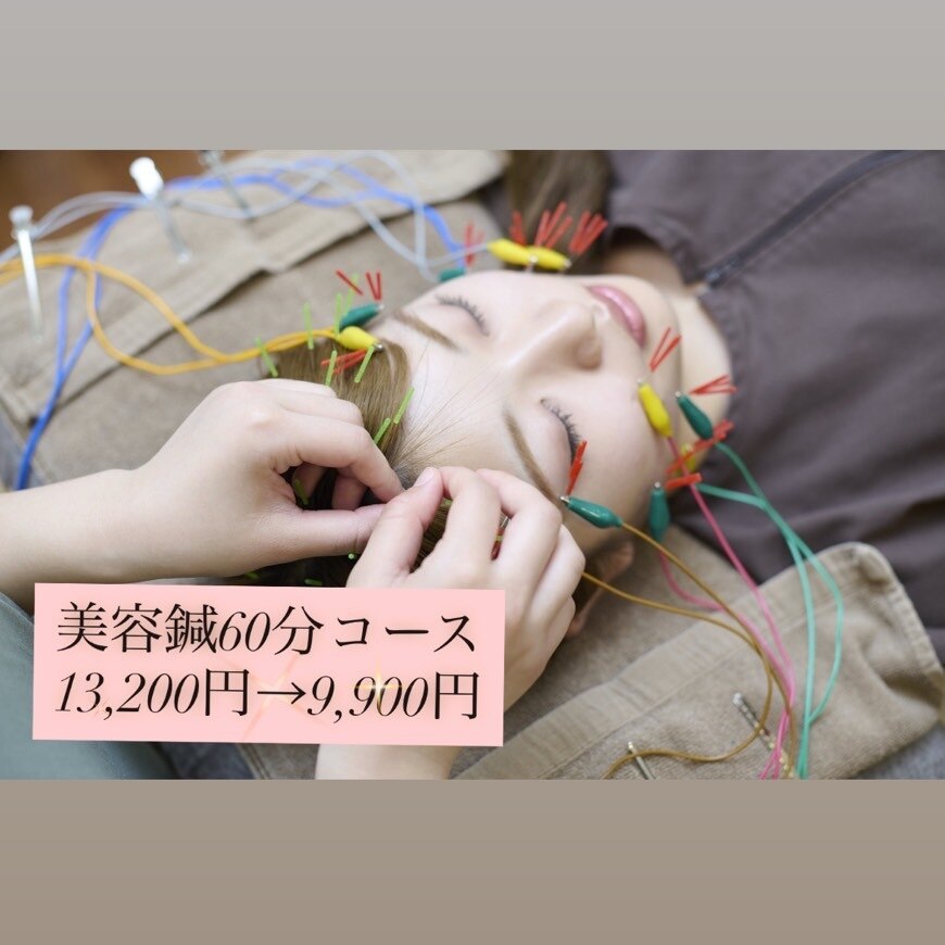 美容鍼 60分 \13,200円→9900円