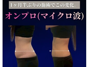 ラフィール/最新下っ腹激締め !! メソッド 