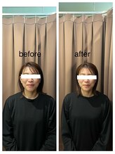 アイリー(Irie)/小顔矯正