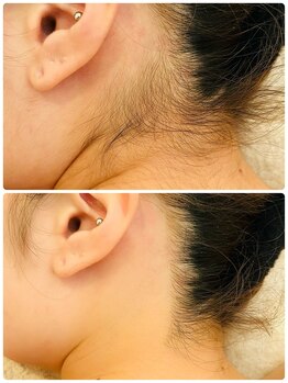 アールイー(Re:)/