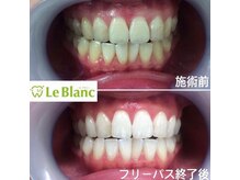 ルブラン 奈良店(Le Blanc)/魅力的な歯に！