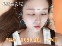 美藤鍼灸院の雰囲気（体験すれば違いがわかる！圧倒的技術力◎【美容鍼/美容鍼灸】）
