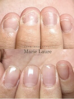 マリーロール 天王寺店(Marie Laure)/自爪育成/深爪矯正/ネイルケア