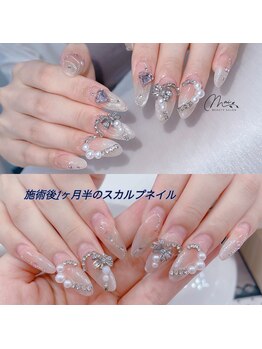 マイ(Mai)/施術から一ヶ月半後スカルプ