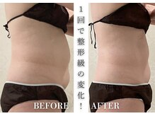 リアレント 高槻店(Lialent)の雰囲気（気になる下っ腹もすっきり♪大人気痩身インディバボディ）