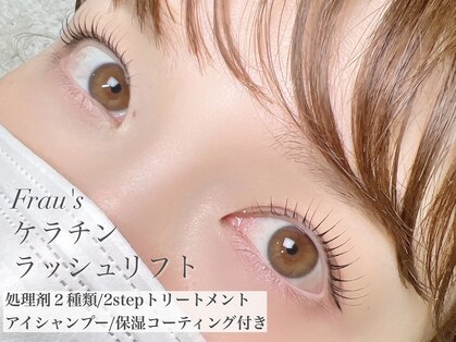 フラウ(Frau)の写真