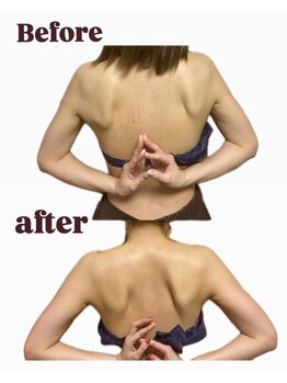 ソバニ(SOBANI)の写真/その背中、実年齢より老けて見えていませんか?
