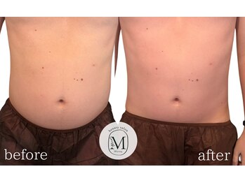 ミヨン(Miyong)/お腹スッキリ◎即変化ボディ