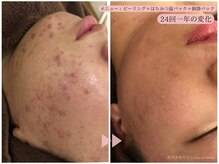 レスイズモア 恵比寿(less is more.)/24回の変化