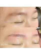 クレー(Klee)/アイブロウリフト