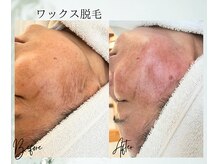 ポノ 茅ヶ崎(Pono.)/湘南/毛穴/ハーブピーリング/眉