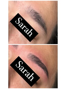 サラ(Sarah)/メンズハリウッドブロウリフト