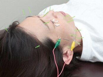 トラスト整骨院鍼灸院の写真/【家事/育児で凝り固まった首肩こりを撃退!】姿勢改善のプロが再発しない身体作りから予防までを徹底指導♪