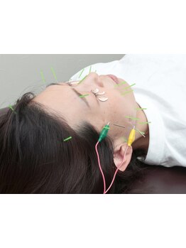 鍼灸施術を受けたい