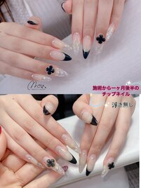 施術から一ヶ月半後チップネイル