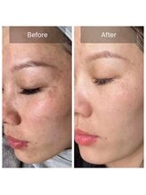 ボディーシェルター 横浜桜木町/ダイヤモンドピール