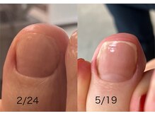 ロンディネ(Rondine)/フットケア32