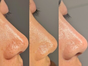 ルーナジェーナ(Luna llena)/